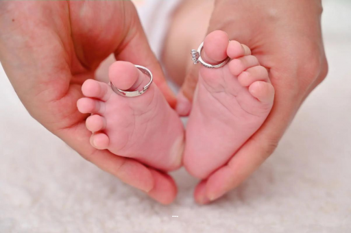 汝州孕妇怎样预防妊娠纹